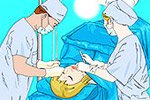 Operate Now: Eye Surgery